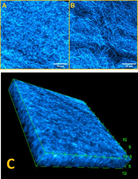 BJNANO - Visualizing nanostructures in supramolecular hydrogels: a ...