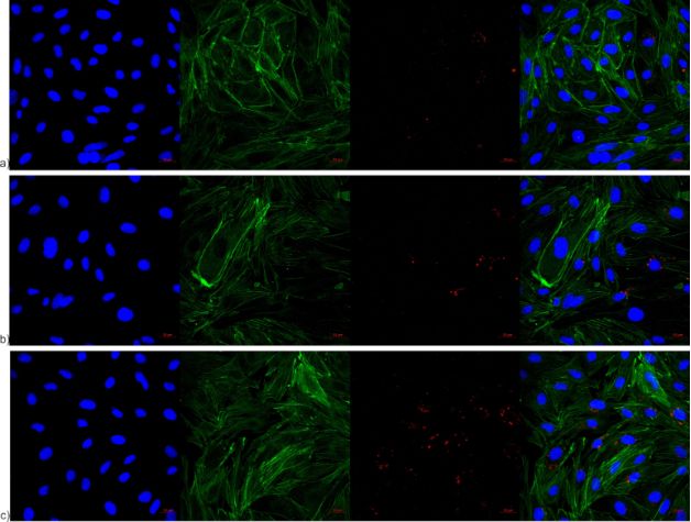 BJNANO - Influence of surface characteristics on the in vitro